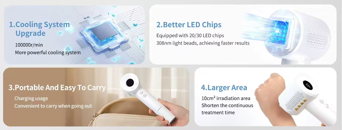 vitiligo lamp vitiligo lamp