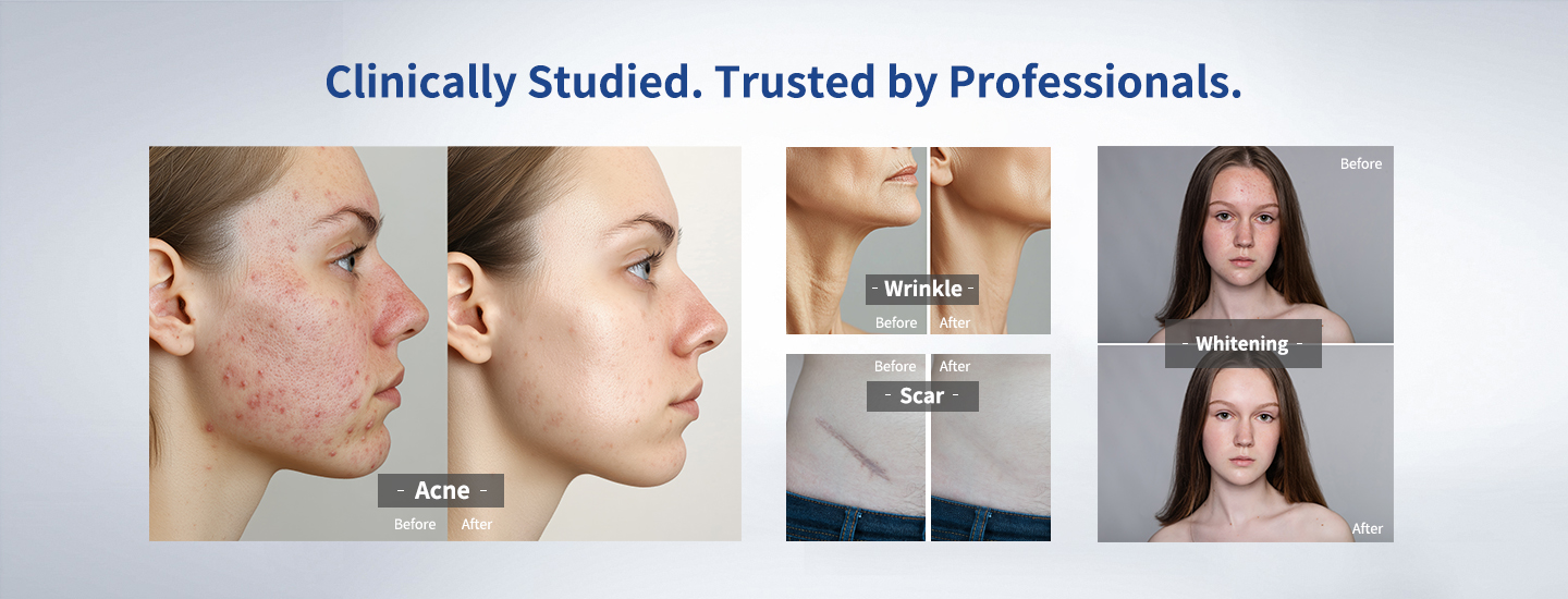 Multi-Wavelength LED Therapy Multi-Wavelength LED Therapy