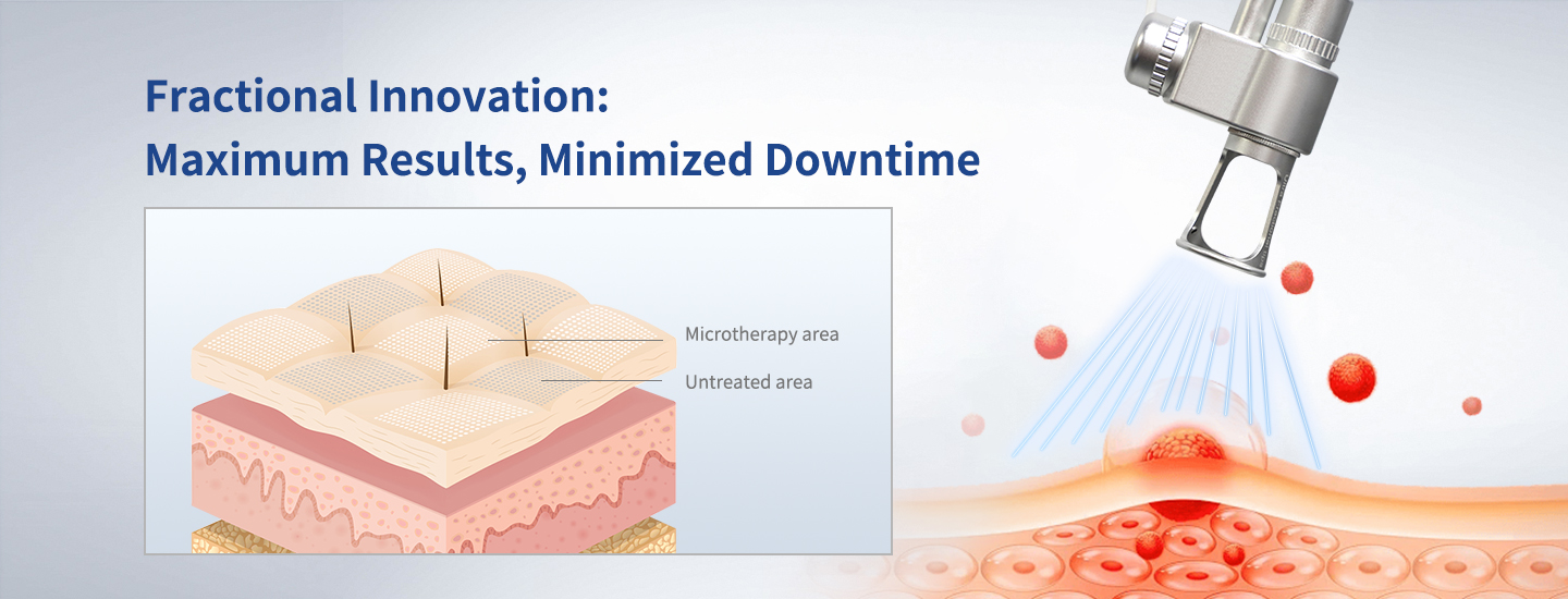 Pulsed CO2 Laser Pulsed CO2 Laser