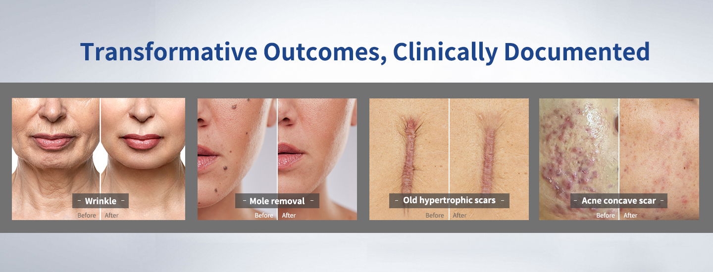 Scanning CO2 Laser System Scanning CO2 Laser System