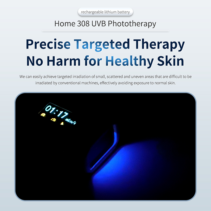 UVB Phototherapy Lamp UV308A1