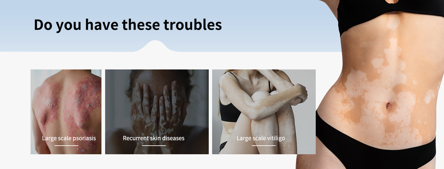 ull Body Phototherapy System Supplier