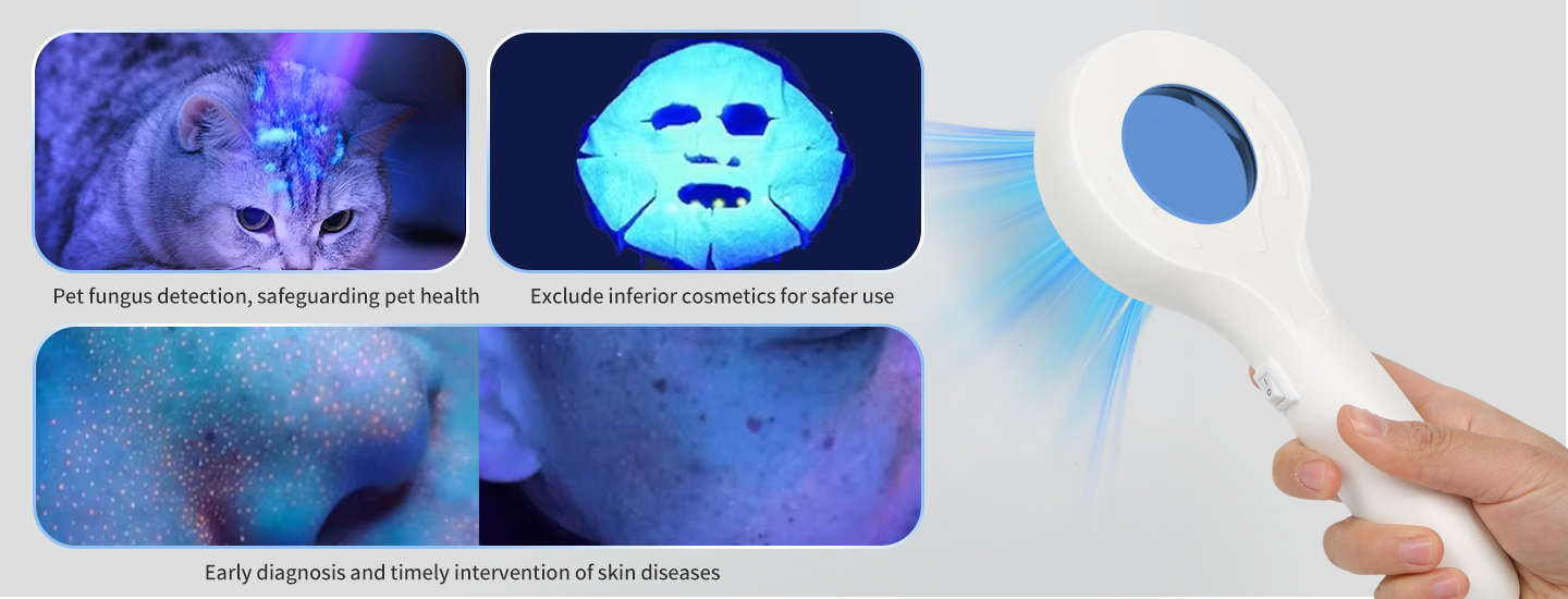 Dermatology Diagnostic Light