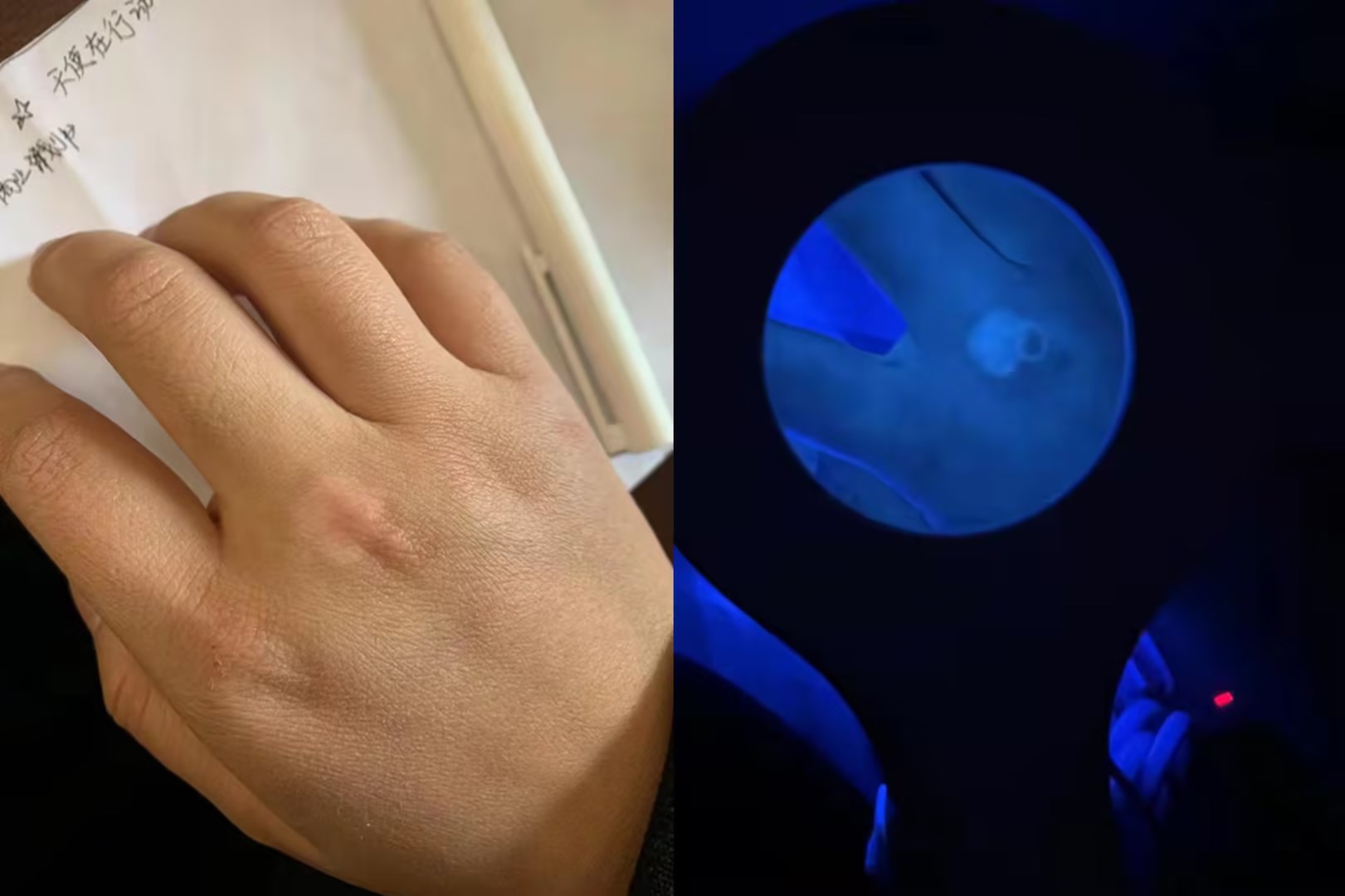 adult use wood\'s lamp