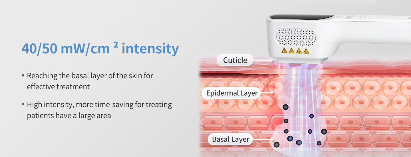 Phototherapy for Vitiligo at Home