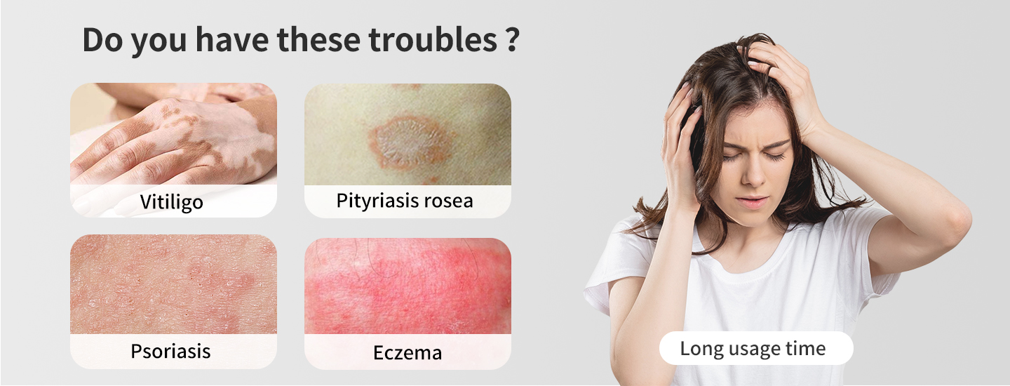 UVB Light Therapy Machine