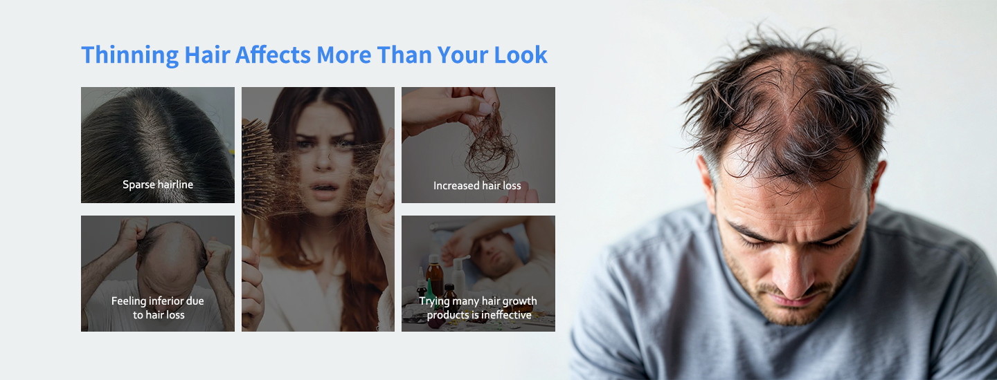 Multi-Diode Laser Hair Therapy System