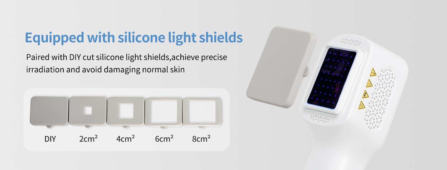 Handheld UVB Phototherapy