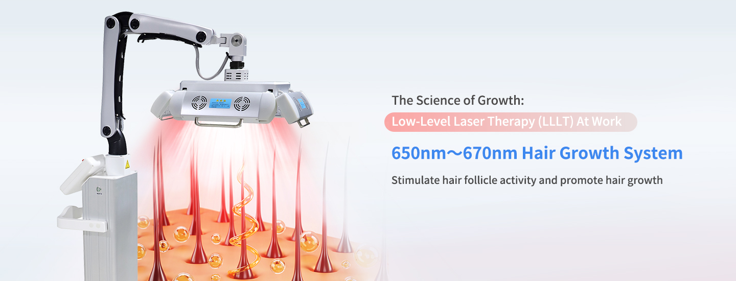 Androgenetic Alopecia Laser Treatment