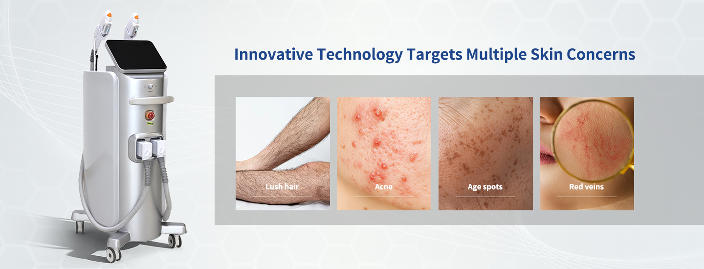 Multi-Wavelength IPL Device