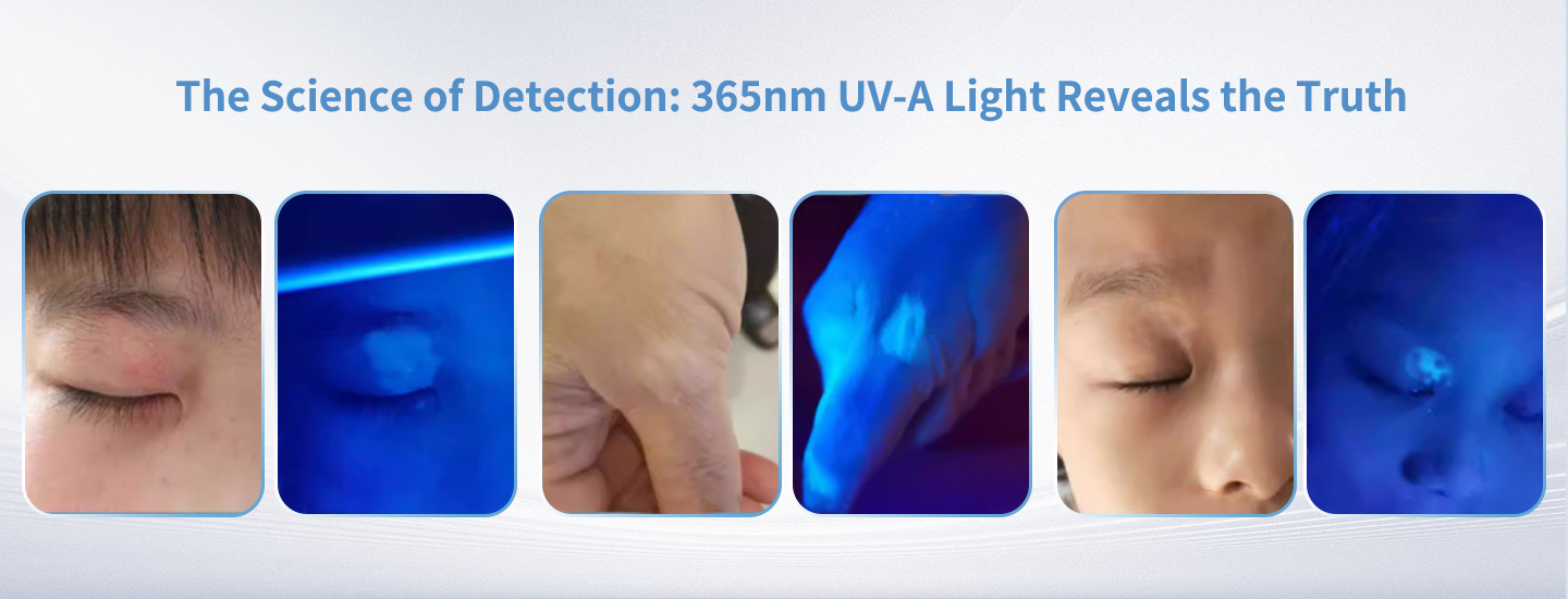Magnifying Woods Lamp